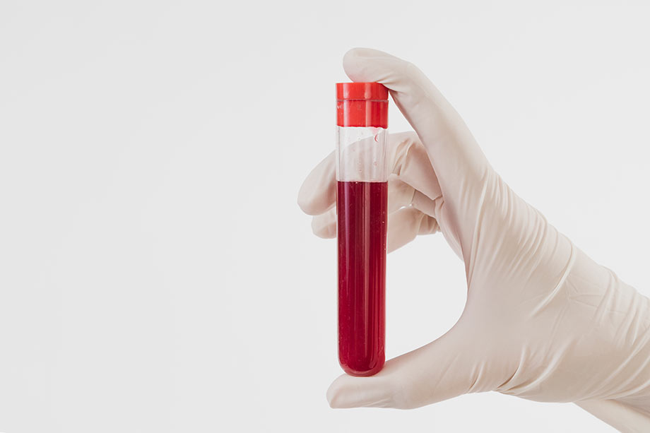¿Qué dice un análisis de sangre acerca de tu salud? - Medical Assistant