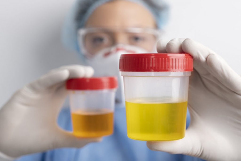 Infección urinaria: ¿cuáles son sus causas, síntomas y formas de prevención? - Medical Assistant