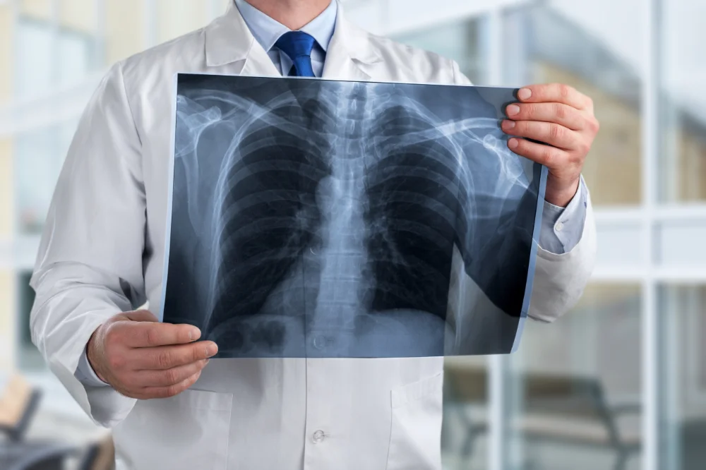 Radiografía de tórax en formato OIT: qué es y por qué no es igual a una radiografía común - Medical Assistant